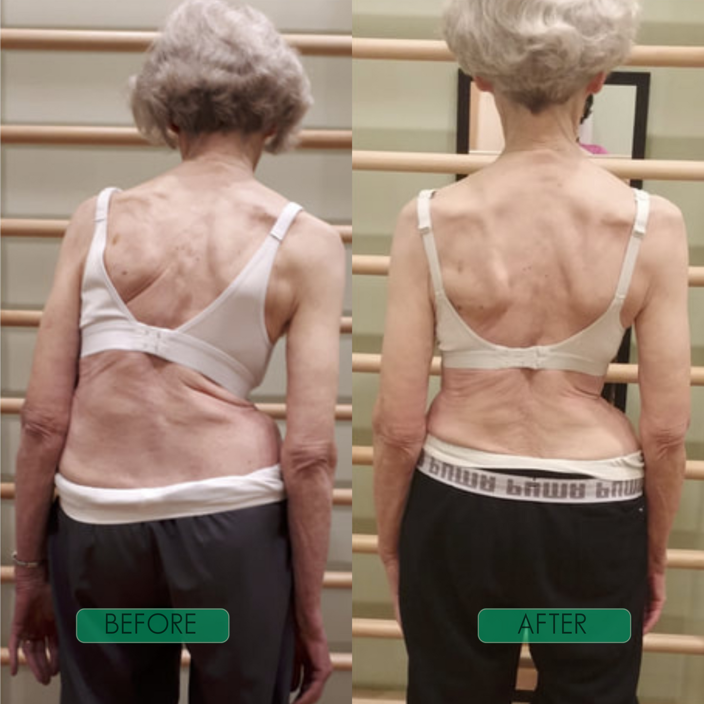 Spinal Re-Adaptation System