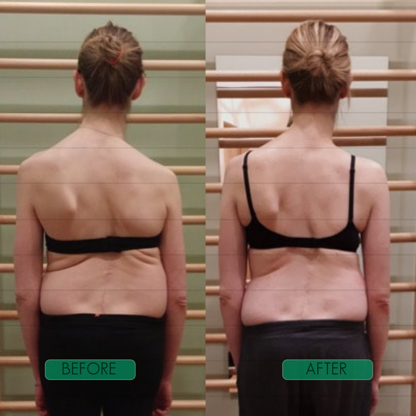 Spinal Re-Adaptation System